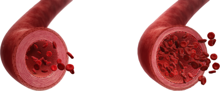 Grafik von Blutgefäßen.